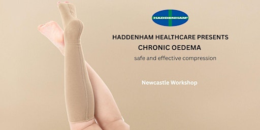 Imagen principal de Chronic Oedema Workshop