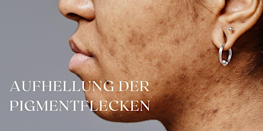 Image principale de Aufhellende Behandlungen für Pigmentflecken