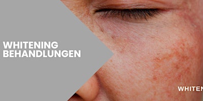 Image principale de Whitening Aufhellende Behandlungen