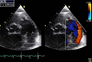 Imagen principal de Monash Cardiorespiratory Symposium (Fetal-Neonatal-Pediatric)