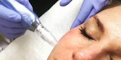 Imagen principal de Microneedling (Licensed Estheticians Only) - MA