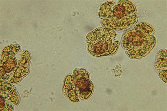 Image principale de Harmful Algal Bloom Training Opportunity