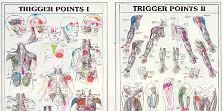 Points gâchettes (trigger points) primary image