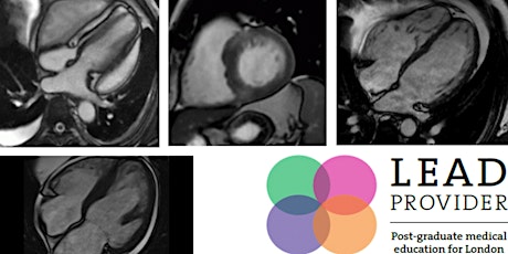 Cardiac MR 3-day HANDS-ON National Virtual Training Course 2-4 Apr 2021 primary image