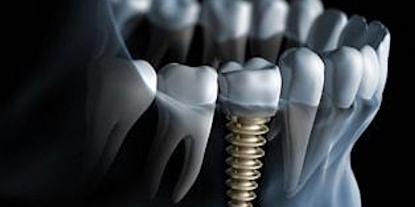 Dental Implant Care with Susan Wingrove.