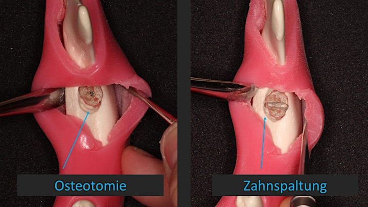 Fortbildung Zahnärztliche Chirurgie - Basics -: Bild