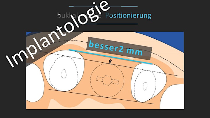 Fortbildung Zahnärztliche Chirurgie - Basics -: Bild