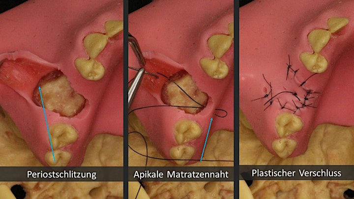 Fortbildung Zahnärztliche Chirurgie - Basics -: Bild