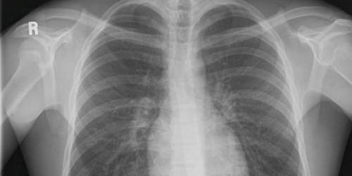 An Overview of IR(ME)R for non-Medical X-ray Referrers (Online) - MTW primary image