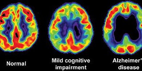 Normal vs. Not Normal Aging: Understanding the Difference primary image