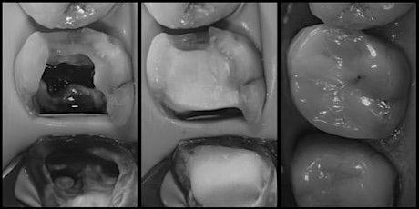 The Endodontic Restorative Interface  5/6 November 2021 primary image