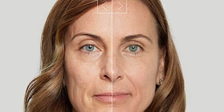 Sculptra Facial Regeneration - MA