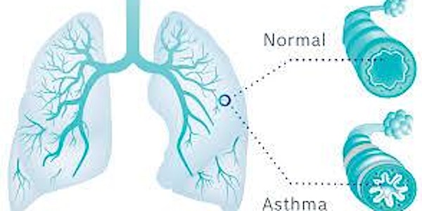 FeNo Testing in the diagnosis & management of Asthma (UK  only) ChWr