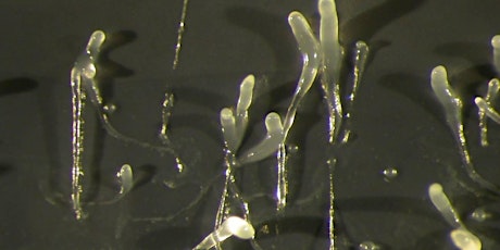 Imagen principal de Estudiando enfermedades, usando modelos: la ameba Dicty