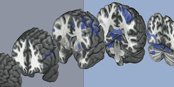 "Meet the Scientists" - Brain Injury