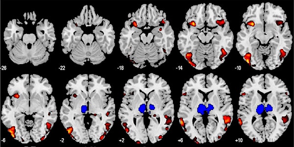 NeuroTech SF 2016