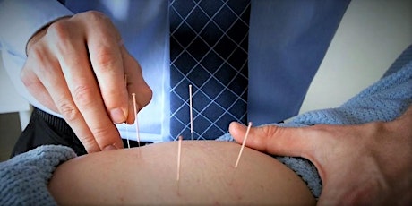 Integrating Medical Acupuncture in treatment of Low Back Pain primary image
