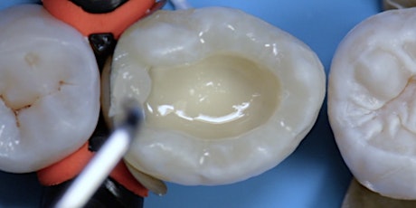 Mastering Direct Posterior Restorations - Full Day Hands-On tickets