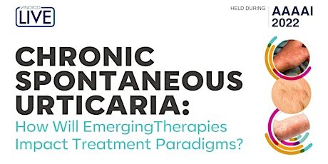 Chronic Spontaneous Urticaria: How Will Emerging Therapies Impact Treatment tickets