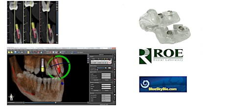 CBCT Planning 102 - CT Planning for beginners - Doctor & /or Staff primary image