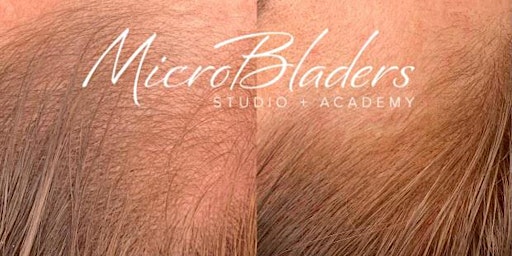 MicroBladers' Las Vegas Machine Hairline Restoration Training Workshop primary image