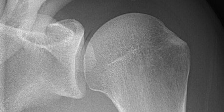 Rehabilitative Examination and Treatment of the Shoulder primary image