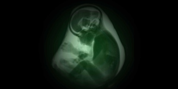 In Utero