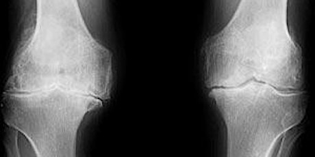 Fight Arthritis and Conquer Bone Health! primary image