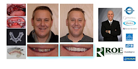 Full Mouth Reconstruction Utilizing the CombiGuideIP - $299 primary image