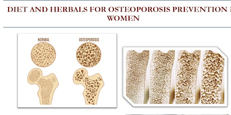 Diet and Herbal Medicines for Osteoporosis Prevention in Women tickets