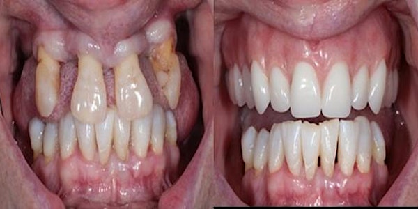 Struggling to make dentures Help is at Hand.	Hands on Course