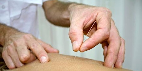 Introduction to Dry Needling October'22 - CPD tickets
