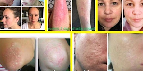 Do you suffer from skin conditions? primary image