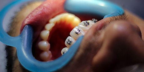 Understanding Orthodontics for the dental Hygienist and OHT tickets