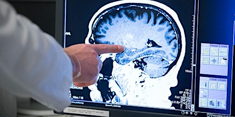 Immagine principale di Focused ultrasound for the delivery of therapeutics to the brain 