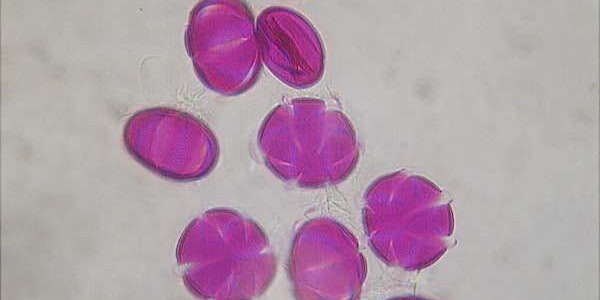 An Introduction to Pollen Microscopy