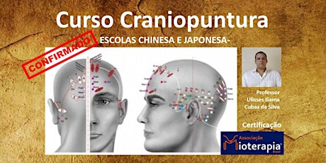 Imagem principal do evento Curso Craniopuntura
