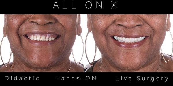 All on X - from A to Z - Didactic , Hands- ON, Live Surgery