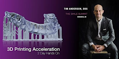 3D Printing Acceleration