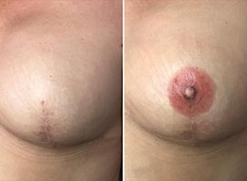 LEARN 3D AREOLA WITH THE GEORGIA SCHOOL OF COSMETICS