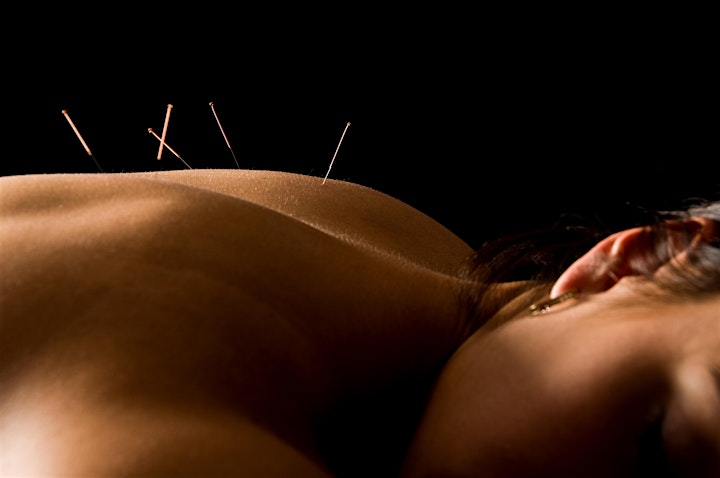 White Lotus Chinese Medicine College Acupuncture Course Introduction image