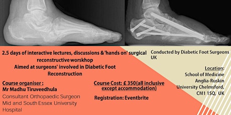 Diabetic Foot Reconstruction Cadaveric Workshop tickets