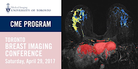 Toronto Breast Imaging Conference (MIM1729) primary image