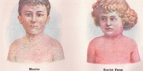 A historical syndemic? Measles and scarlet fever in Victorian goldfields tickets