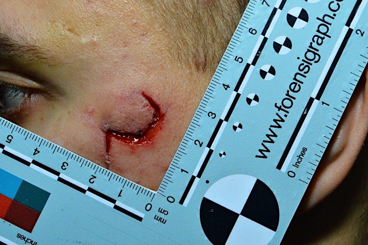 Scratching the surface - Exploring the forensic significance of injuries image