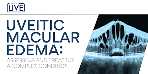 Uveitic Macular Edema: Assessing and Treating a Complex Condition