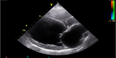 New Dates: Basic Echocardiography - 2-Part Course - Vet CPD