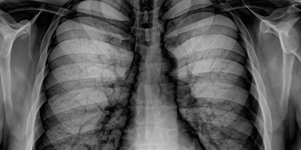 The Link Between Coal Mining and Lung Disease