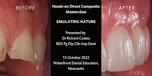 Emulating Nature - Hands-on Direct Composite Masterclass