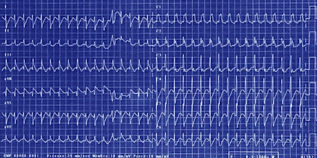 Arrhythmias ECG Workshop 1 primary image